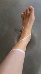 What is the difference between Kinesio®tape and athletic tape? - Physical  Therapy Portland